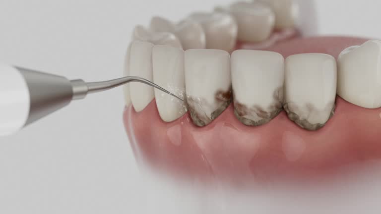 Trusted Tooth Extraction service in South Lakes, AK - Dentist Open Now